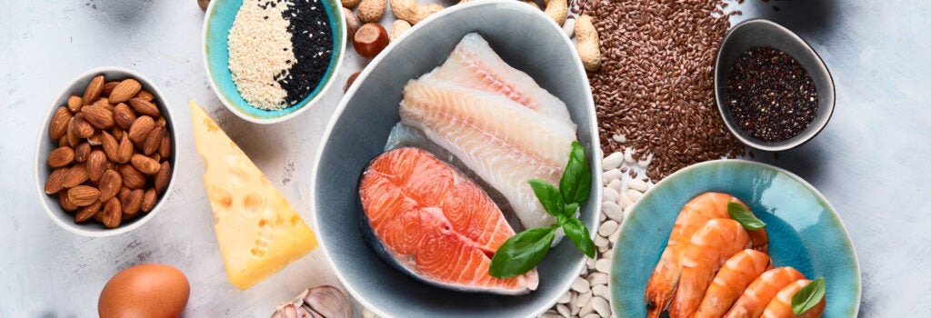foods containing phosphorus, including nuts and seeds, salmon, eggs, cheese